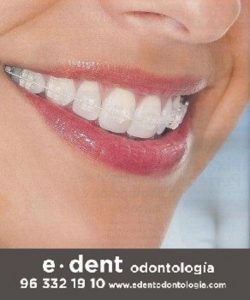 Ortodoncias en Valencia